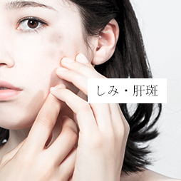 しみ・肝斑 